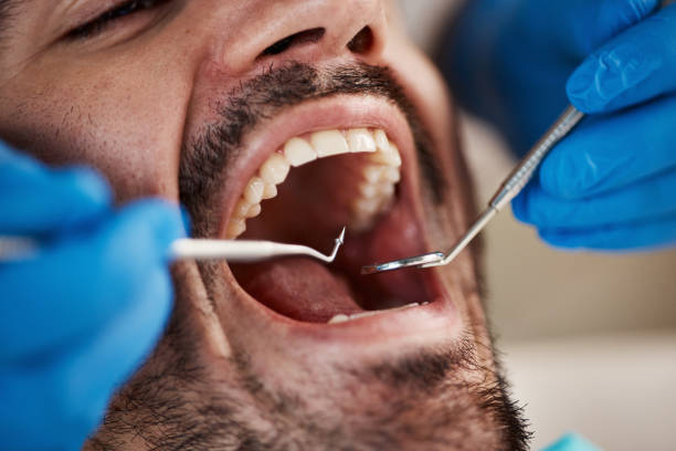 Best Emergency Tooth Extraction in St Georges, DE